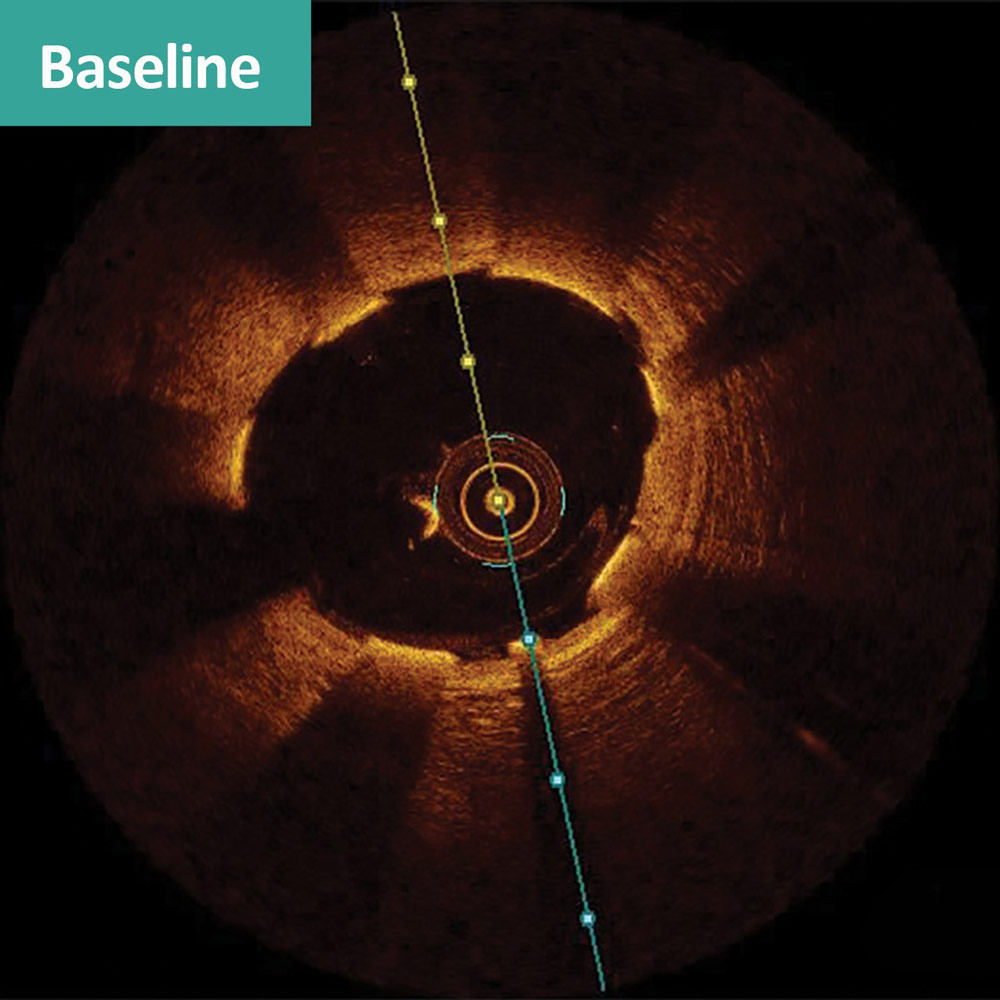 Baseline