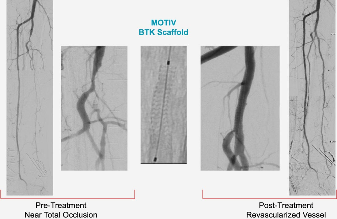 MOTIV – BTK Case Sample